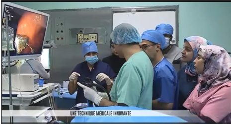 Première plicature endoscopique au CHU Ibn Rochd et au Maroc